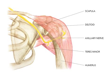 Anterior Shoulder Dislocation Axillary Nerve