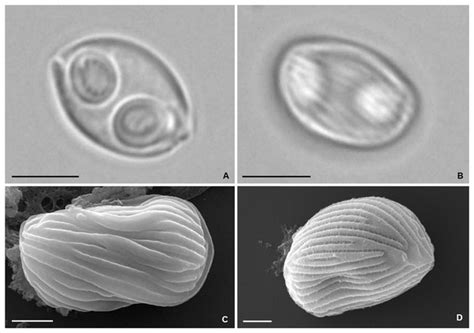 Occurrence Of Two Myxosporean Parasites In The Gall Bladder Of White