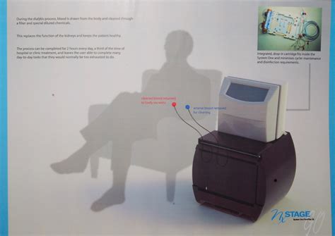 NXstage GO - Portable Dialysis Machine by Samuel Johnson at Coroflot.com