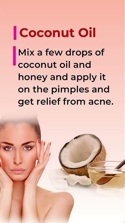 How To Get Rid Of Acne With Home Remedies Youtube