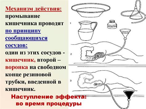 Клизмы. Газоотводная трубка - презентация онлайн