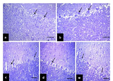 A A Photomicrograph Of A Section In The Control Cerebellar Cortex Download Scientific Diagram