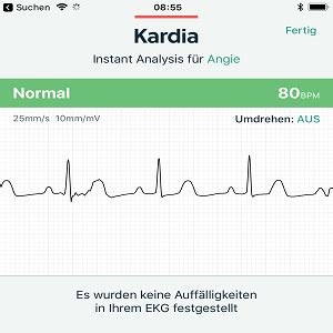 Alivecor Kardiamobile Ekg Monitor Von Fda Zugelassen Kabelfrei