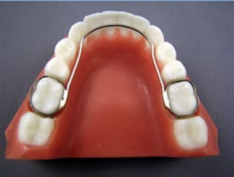 Orthodontic Appliances Saxe Orthodontics