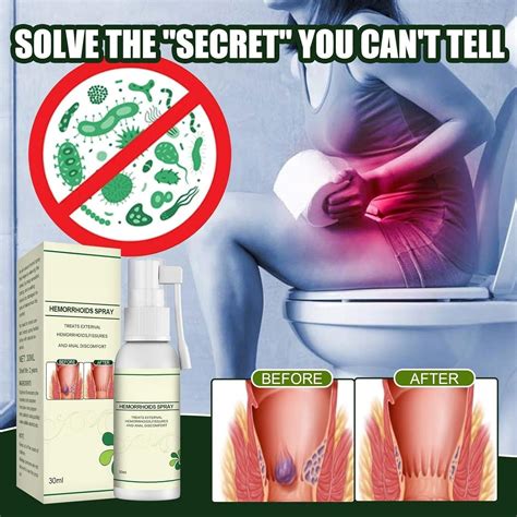 Hemorrhoids Treatment Spray For Fast Relief 30ml Natural Hemorrhoid Relief For Anal Itching