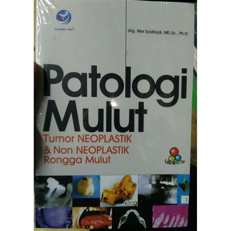 jual patologi mulut tumor neoplastik   neoplastik rongga mulut