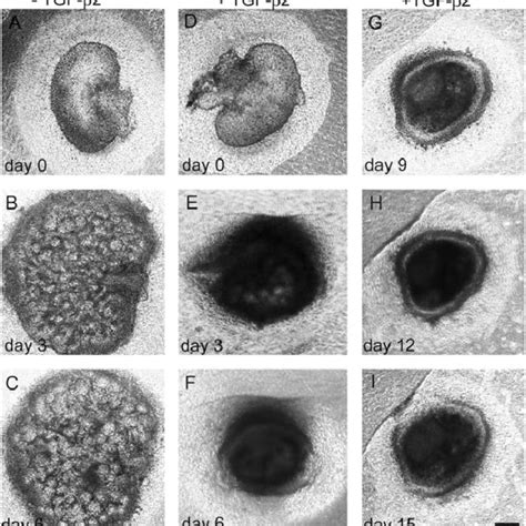 Phase Contrast Photomicrographs Of Whole Mouse Metanephroi Cultured In