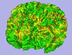 2009 Summer Project Week Slicer3 Cortical Thickness Pipeline - NAMIC Wiki