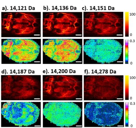 Figure From Proteoformselective Imaging Of Tissues Using Mass