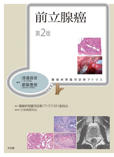 楽天ブックス 前立腺癌 第2版腫瘍病理鑑別診断アトラス 渡邉 昌俊 9784830622687 本