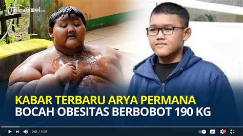 Ingat Arya Permana Bocah Obesitas Berbobot 190 Kg Dulu Viral Begini