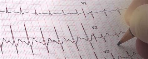 EKG Technician Certification - Continuing Education | UTRGV