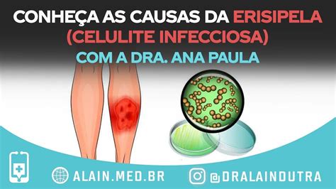 Erisipela O Que Causa - Erisipela Causas Fatores De Risco Sinais Sintomas O que é eclâmpsia e ...