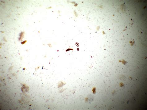 Balantidium Coli Trophozoite Parasitology