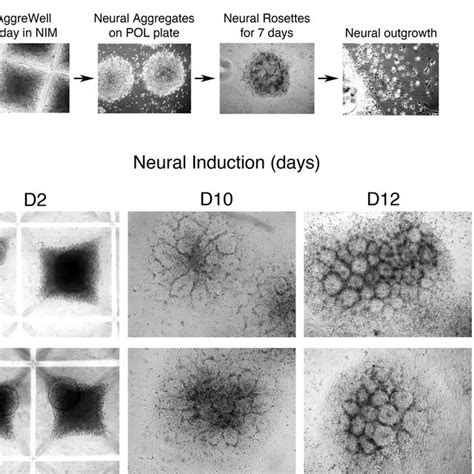 Neural Differentiation Of Human Embryonic Stem Cells In Vitro A