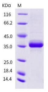 Human Recombinant EGF Epidermal Growth Factor Protein Fc Tag From