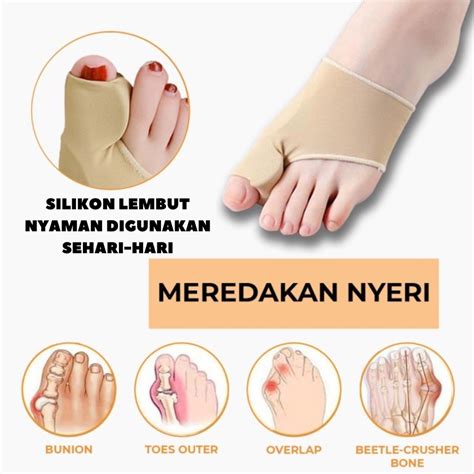 Jual Alat Terapi Sleeve Korektor Tulang Jempol Bunion Corrector Anti