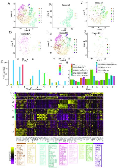 Metastatic Progression Of Pancreatic Ductal Cell Carcinoma Pdac Is