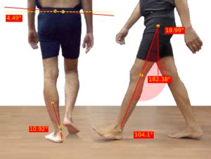 GaitON Gait Analysis System Easy To Use And Accurate