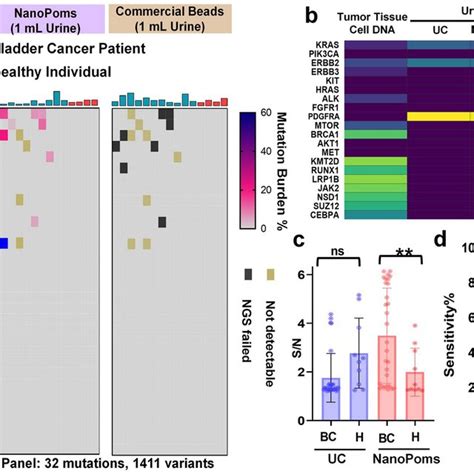 The Proteomic Analysis Of Bladder Cancer Patient Urinary Exosomes A