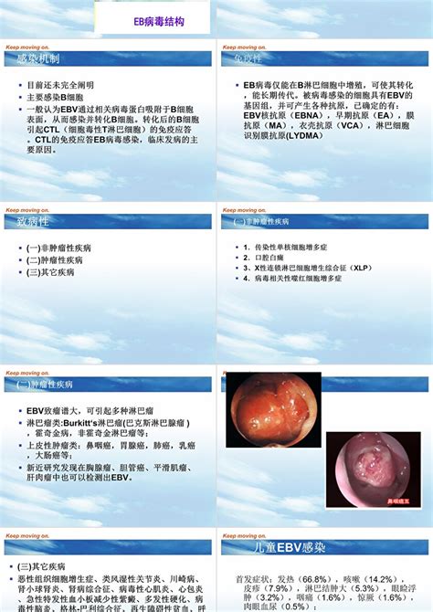 Eb病毒感染及传染性单核细胞增多症ppt模板 卡卡办公