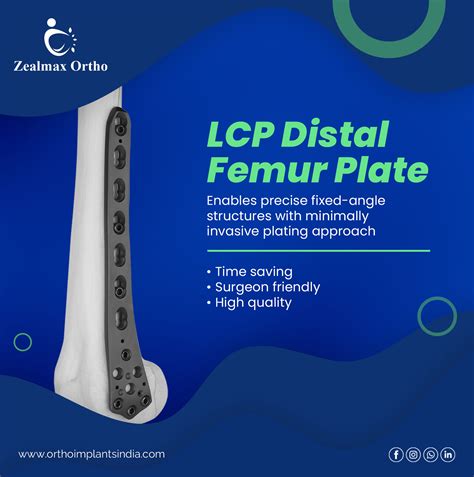 The LCP Distal Femur Plate... - Zealmax Orthopedic Implants | Facebook