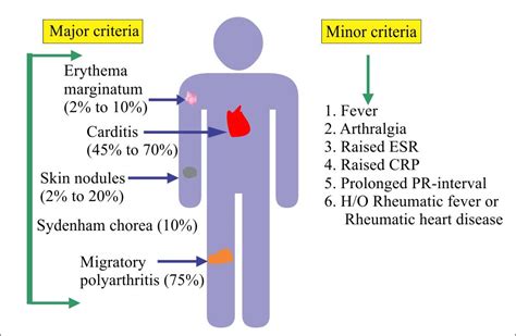 Chapter 25 Autoimmune Diseases Rheumatic Fever