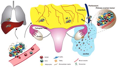 Cells Free Full Text Targeting Cancer Stem Cells To Overcome