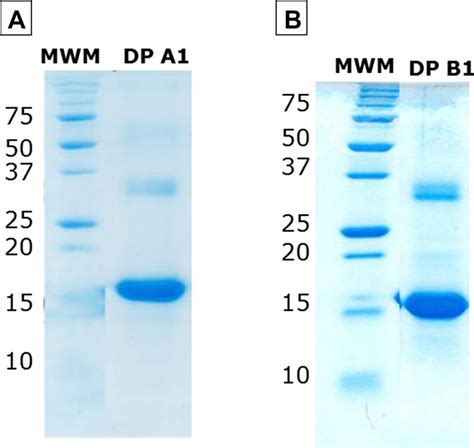 Electrophoretic Profile By Sds Page Of The Mutein Il 2 Obtained By