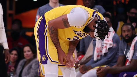 Anthony Davis Injury Update Will Lakers Star Miss Any Games