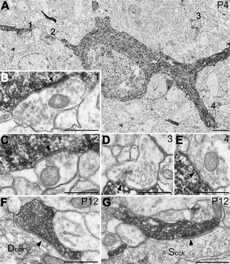 A Low Power Electron Micrograph Of Synaptic Inputs On Dendrites Of A