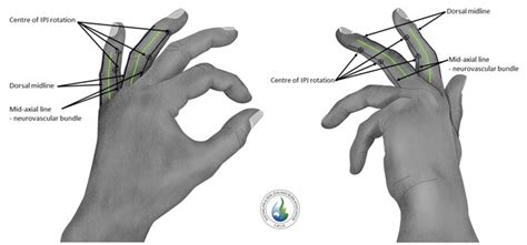 Evaluation Of Updated National Burn Service Escharotomy Guidelines