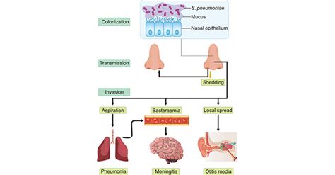 Streptococcus Pneumoniae Disease