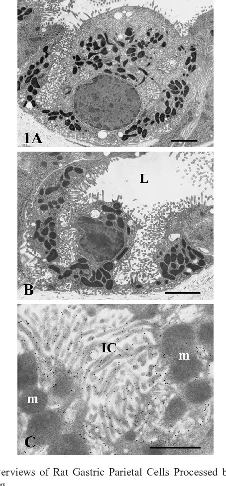 Figure From Functional Transformation Of Gastric Parietal Cells And