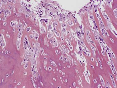 Current Concepts Of Odontogenic Tumours An Update Diagnostic