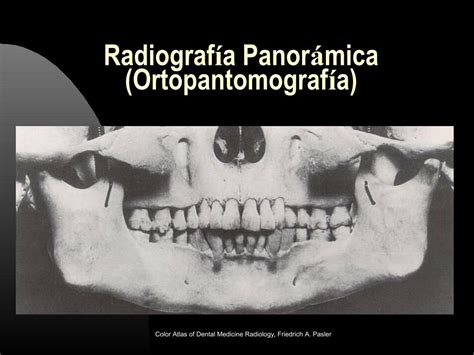 PDF Técnicas radiográficas oclusales y ortopantomografía DOKUMEN TIPS