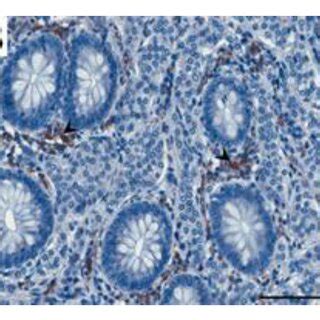 Representative Light Micrographs Showing FSHR Immunoexpression In