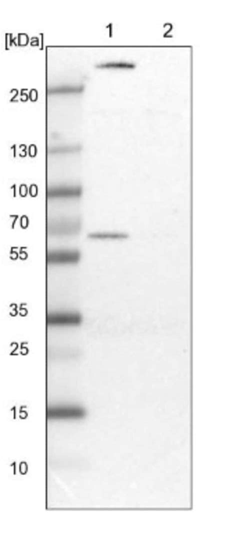 Pgm Antibody Novus Biologicals Ml Unlabeled Fisher Scientific