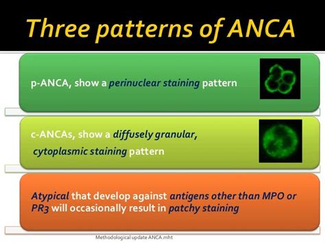 Anca Anti Neutrophil Cytoplasmic Antibodies Ancas