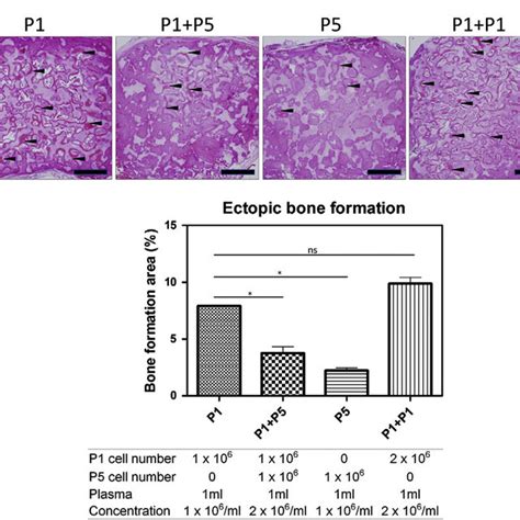 Bone Formation Analyses A In Vivo Bone Formation Analysis At