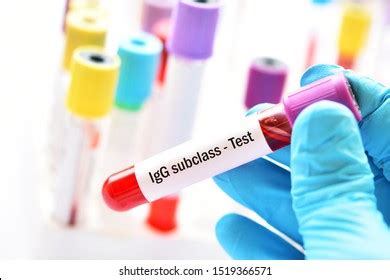 47 Immunoglobulin m Images, Stock Photos & Vectors | Shutterstock