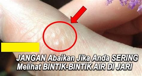 Wajib Tahu Jangan Abaikan Jika Anda Sering Melihat Bintik Bintik