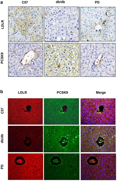 The Relationship Of Ldlr And Pcsk9 Expression In The Liver A