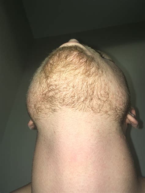 18 Year Old Blonde Beard Page 3 Beard Board
