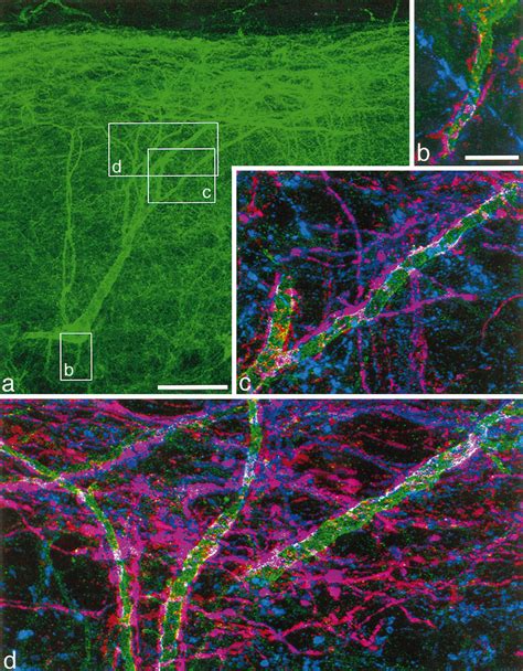 An Nk1 Receptor Immunoreactive Neuron With The Cell Body 290 M Below