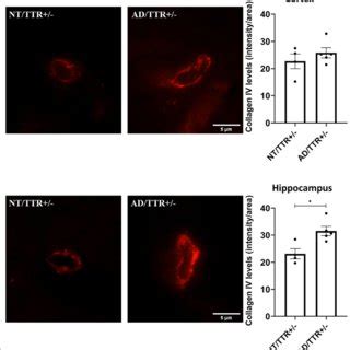 TTR Angiogenic Activity A Representative Images Of Tube Formation By