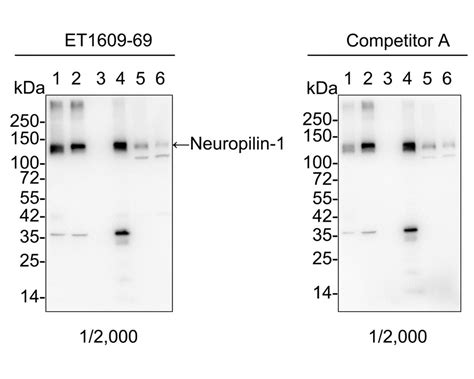 Neuropilin Recombinant Rabbit Monoclonal Antibody St Et