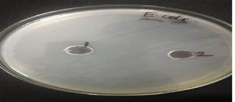 Cup Plate Method Determining Activity Against E Coli Download