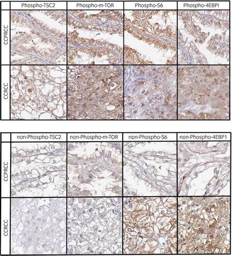 The Staining Properties Of Both Phosphorylated And Nonphosphorylated