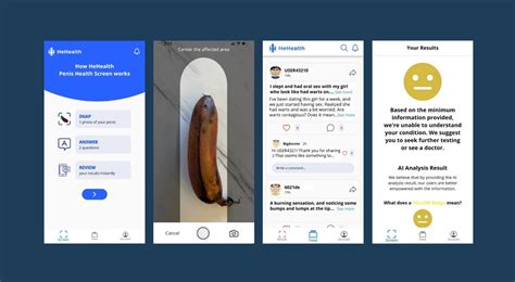 Spore App Uses Ai To Analyze Your Dick Pic For Any Potential Signs Of Stds Tech